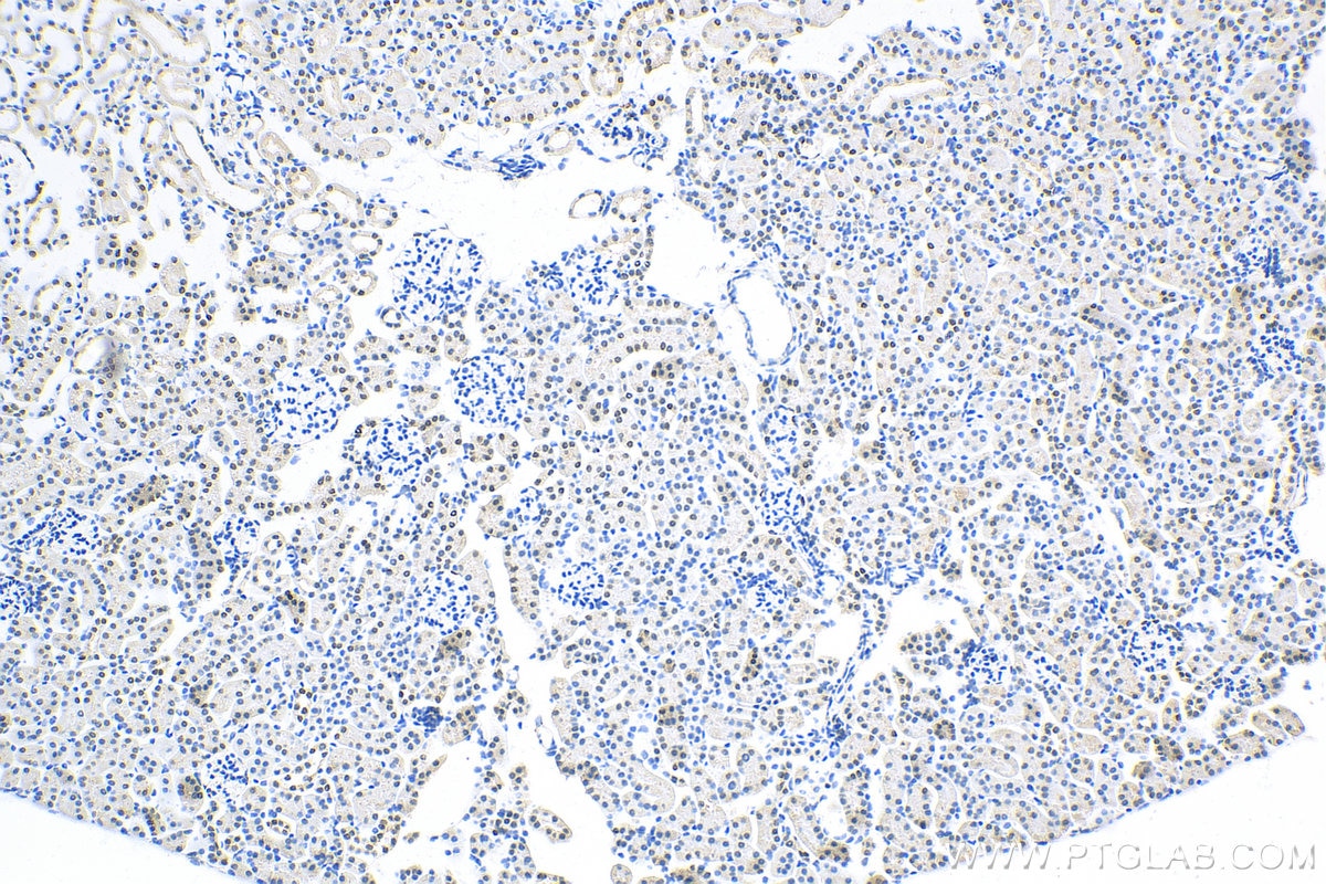 Immunohistochemistry (IHC) staining of mouse kidney tissue using PAX8 Recombinant antibody (80756-1-RR)