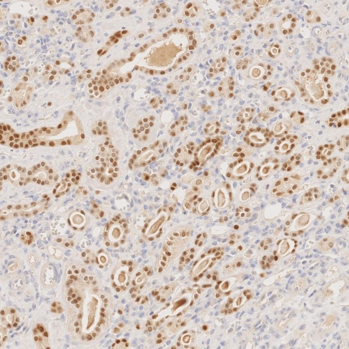 Immunohistochemistry (IHC) staining of human kidney tissue using PAX8 Recombinant monoclonal antibody (80756-1-RR)