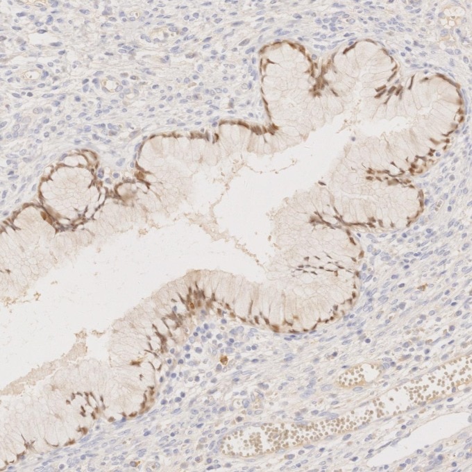 Immunohistochemistry (IHC) staining of human cervix tissue using PAX8 Recombinant monoclonal antibody (80756-1-RR)