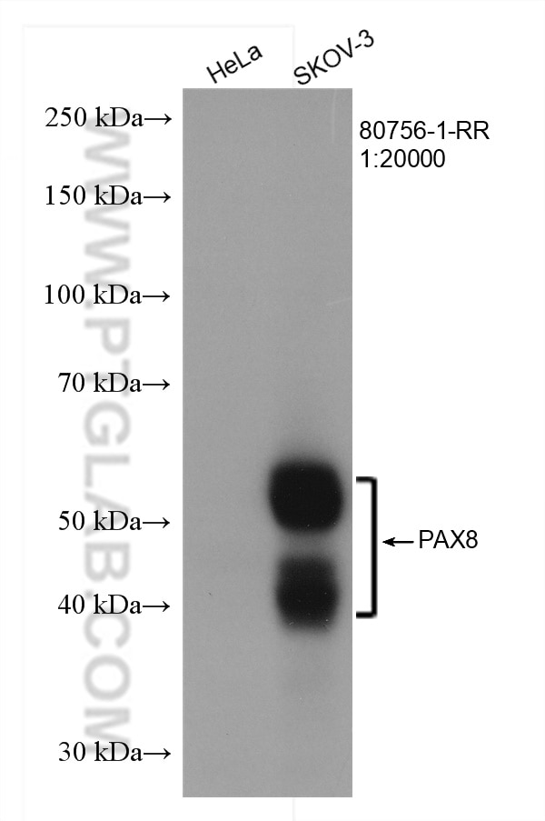 Western Blot (WB) analysis of various lysates using PAX8 Recombinant antibody (80756-1-RR)