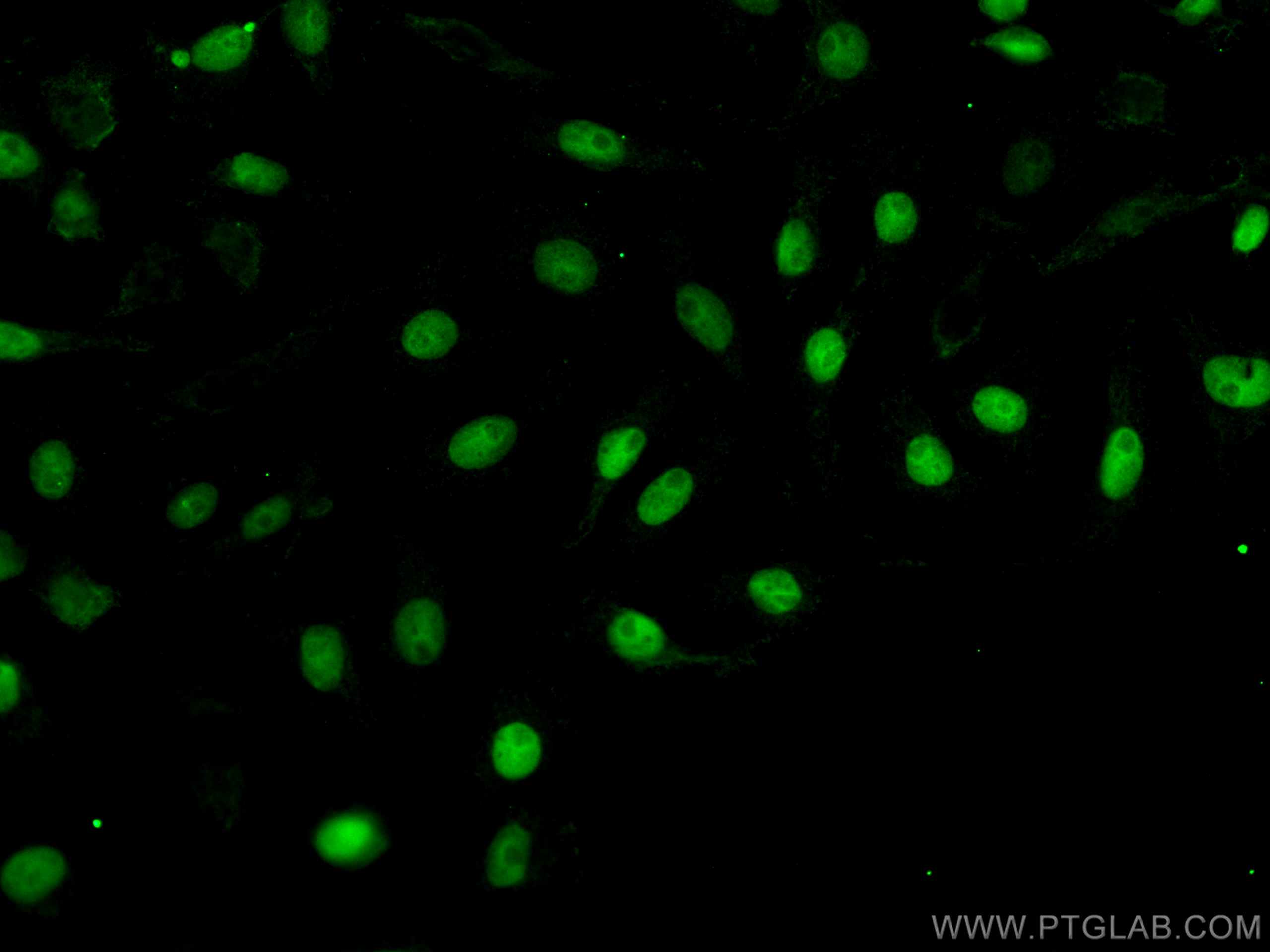 Immunofluorescence (IF) / fluorescent staining of SKOV-3 cells using CoraLite® Plus 488-conjugated PAX8 Polyclonal anti (CL488-10336)