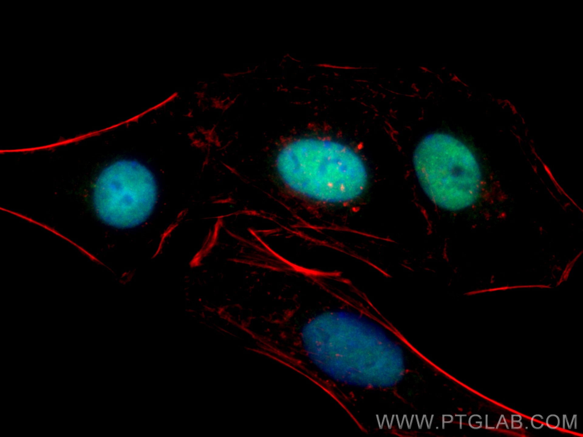 Immunofluorescence (IF) / fluorescent staining of SKOV-3 cells using CoraLite® Plus 488-conjugated PAX8 Monoclonal anti (CL488-60145)