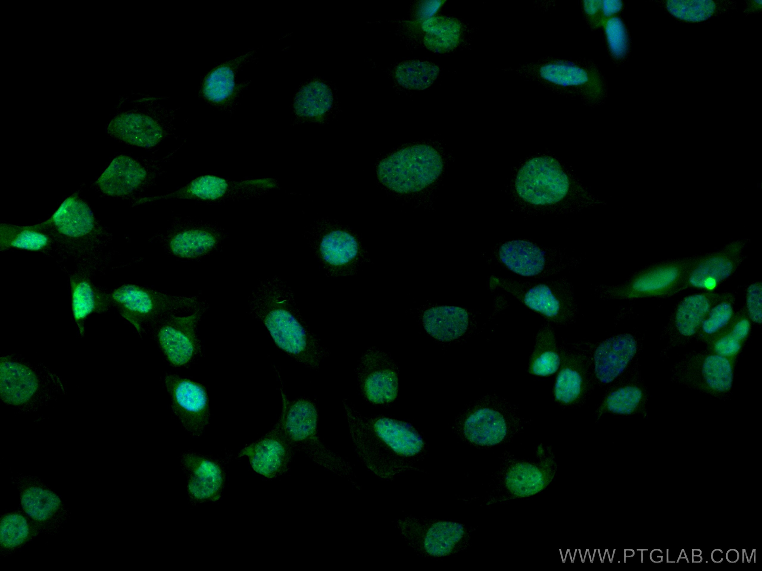 Immunofluorescence (IF) / fluorescent staining of SKOV-3 cells using CoraLite® Plus 488-conjugated PAX8 Recombinant ant (CL488-80756)