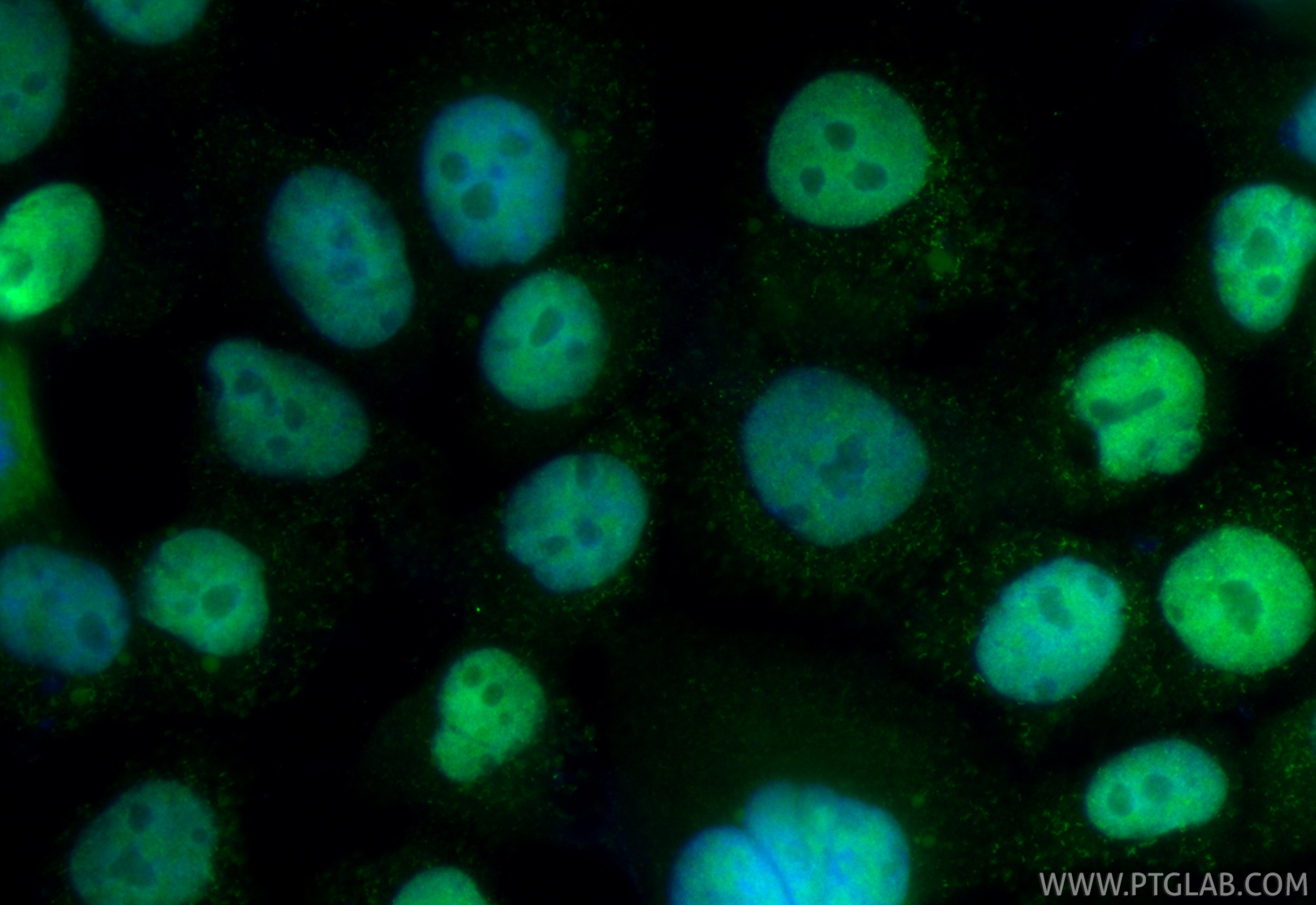 IF Staining of OVCAR-3 using CL488-81032 Immunofluorescence (IF) / fluorescent staining of OVCAR-3 cells using CoraLite® Plus 488-conjugated PAX8 Recombinant mon (CL488-81032)