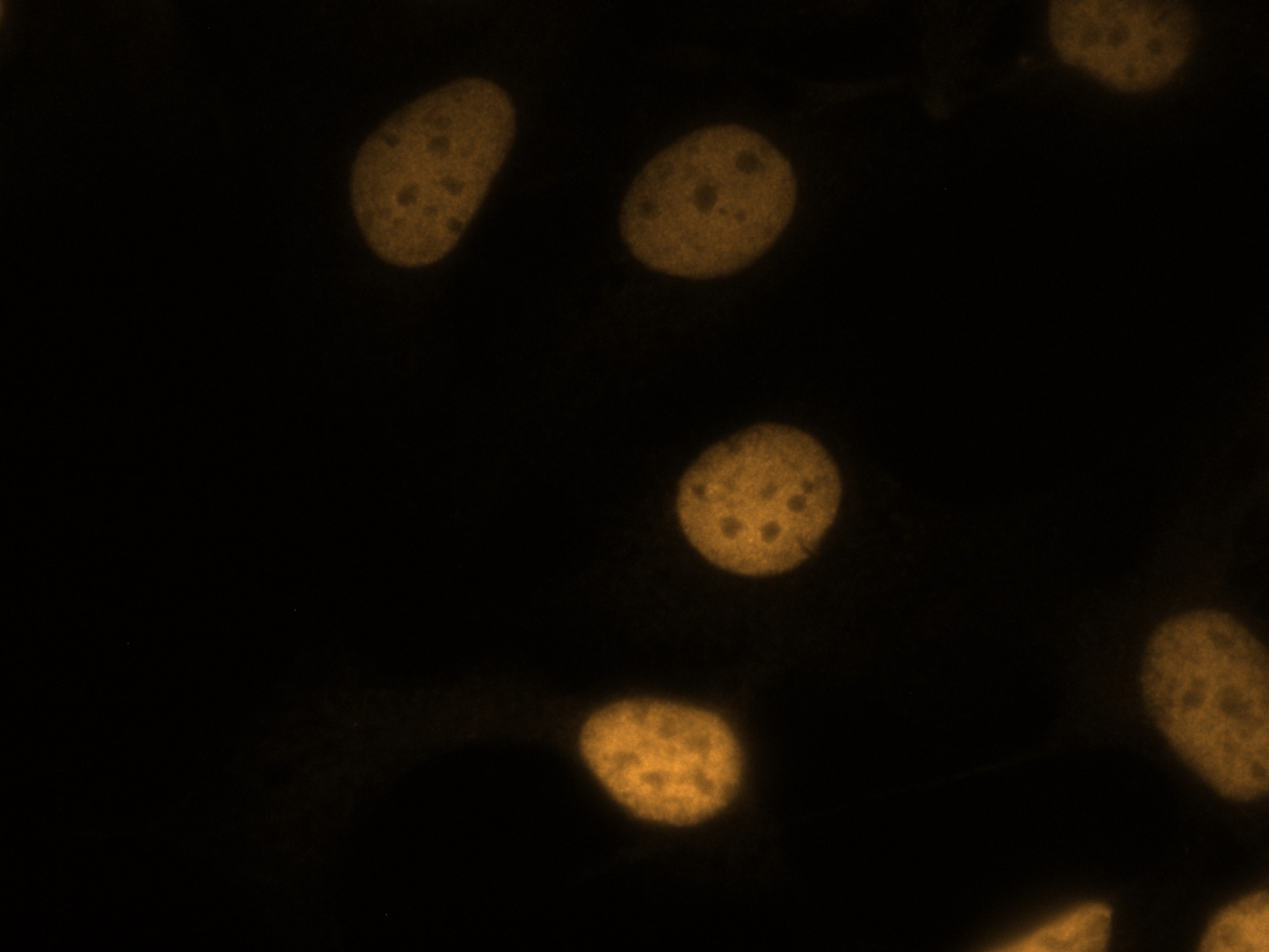 Immunofluorescence (IF) / fluorescent staining of SKOV-3 cells using CoraLite®555-conjugated PAX8 Polyclonal antibody (CL555-10336)