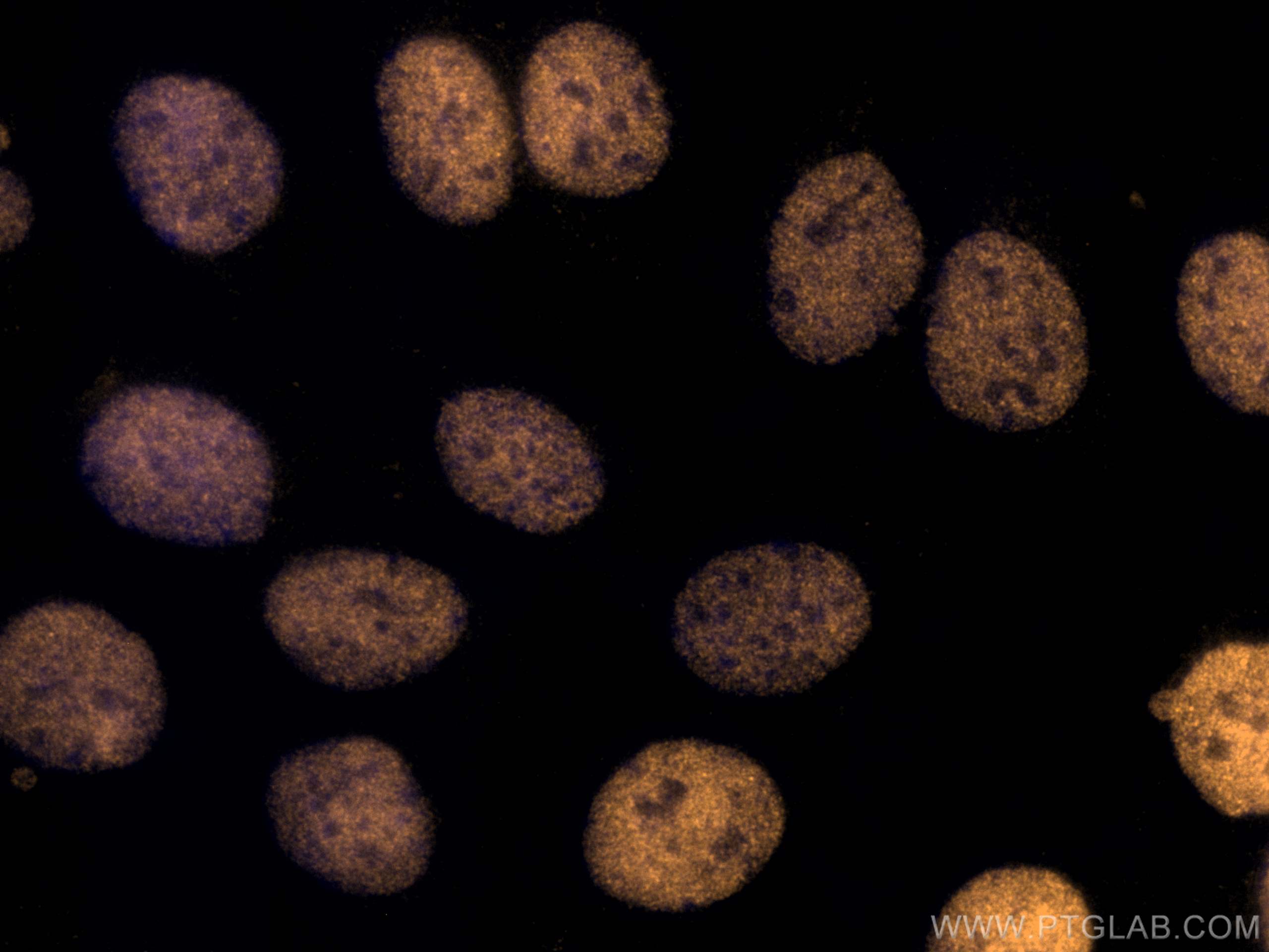 IF Staining of SKOV-3 using CL555-10336