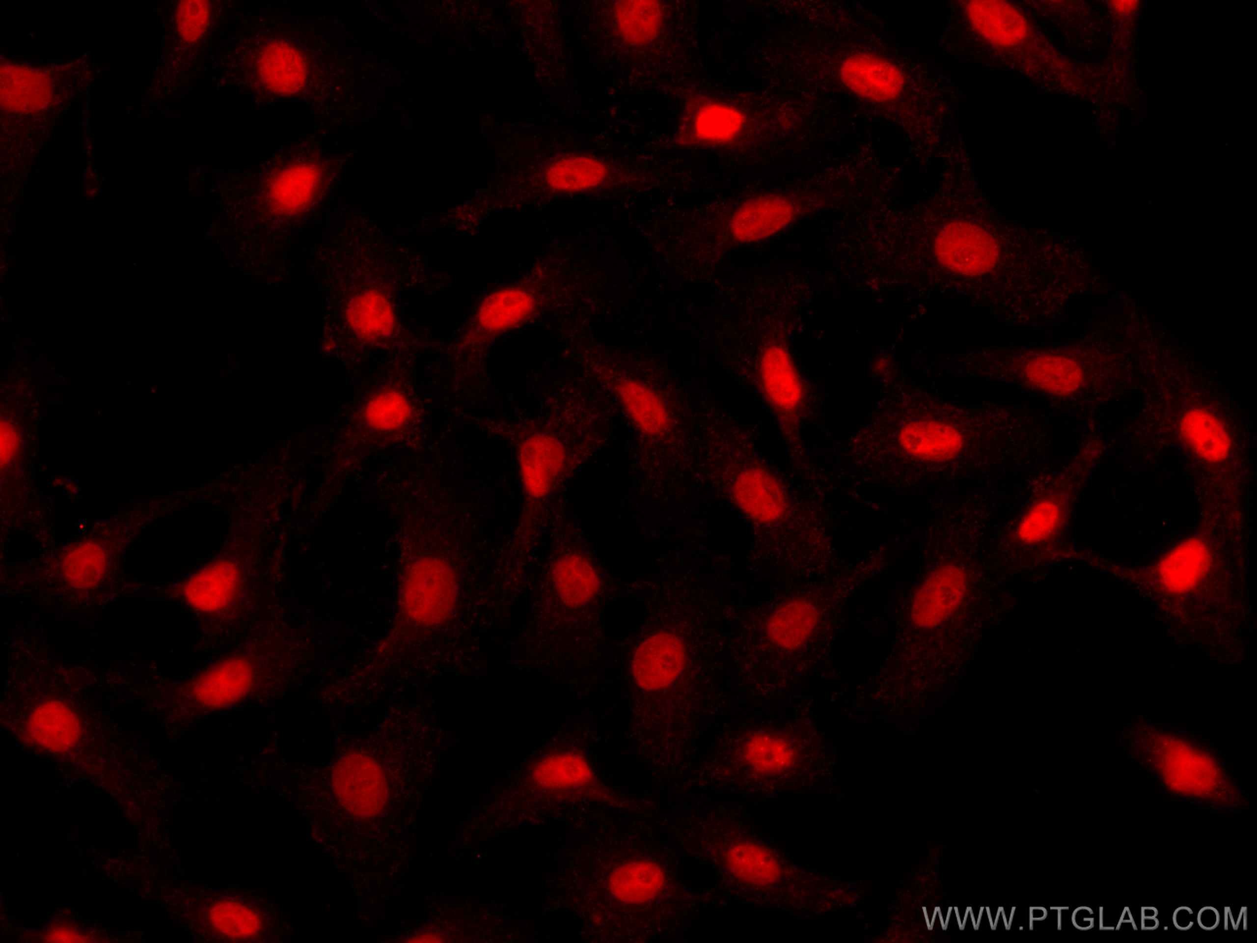 IF Staining of SKOV-3 using CL594-10336