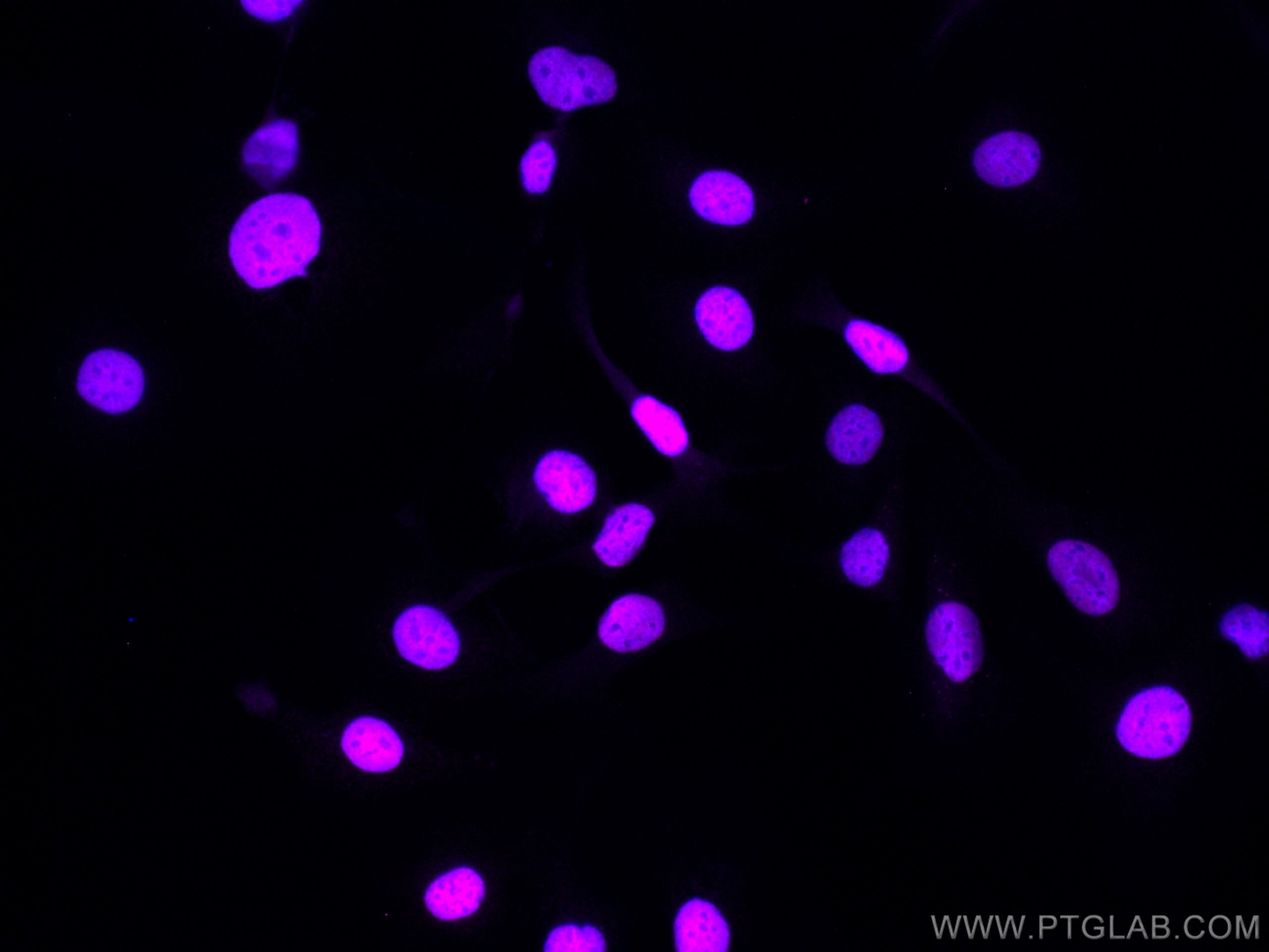 Immunofluorescence (IF) / fluorescent staining of SKOV-3 cells using CoraLite® Plus 647-conjugated PAX8 Polyclonal anti (CL647-10336)