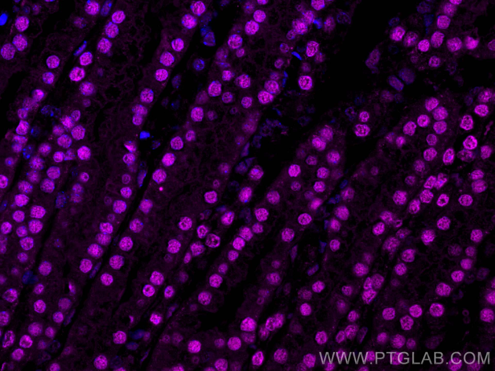 Immunofluorescence (IF) / fluorescent staining of mouse kidney tissue using CoraLite® Plus 647-conjugated PAX8 Polyclonal anti (CL647-10336)