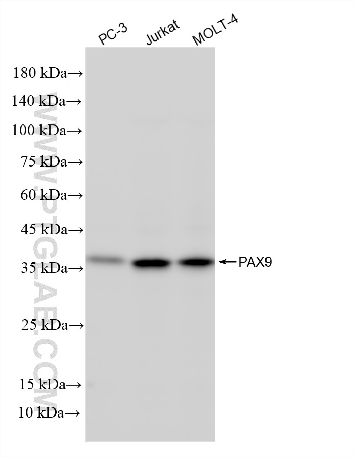 WB analysis using 87678-3-RR (same clone as 87678-3-PBS) Western Blot (WB) analysis of various lysates using PAX9 Recombinant monoclonal antibody (87678-3-RR)
