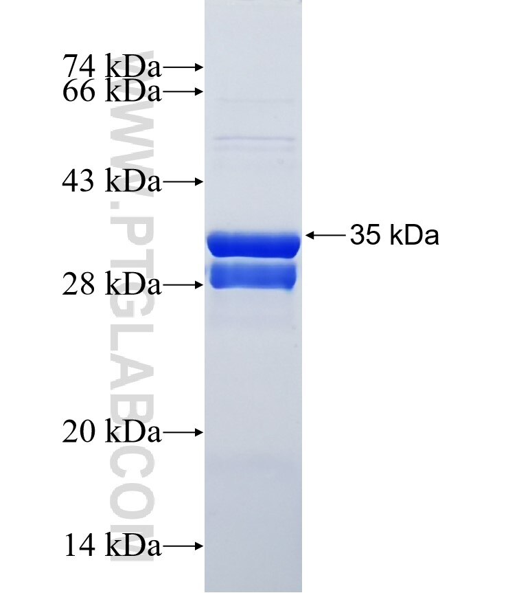 PAX9 fusion protein Ag25381 SDS-PAGE