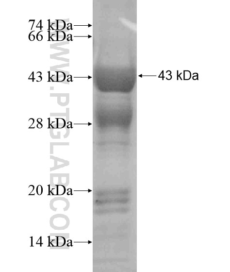 PAX9 fusion protein Ag19010 SDS-PAGE PAX9 fusion protein Ag19010 SDS-PAGE