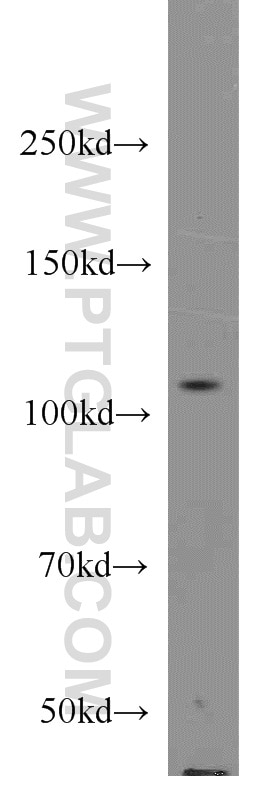 Western Blot (WB) analysis of HeLa cells using PTIP Polyclonal antibody (15034-1-AP)