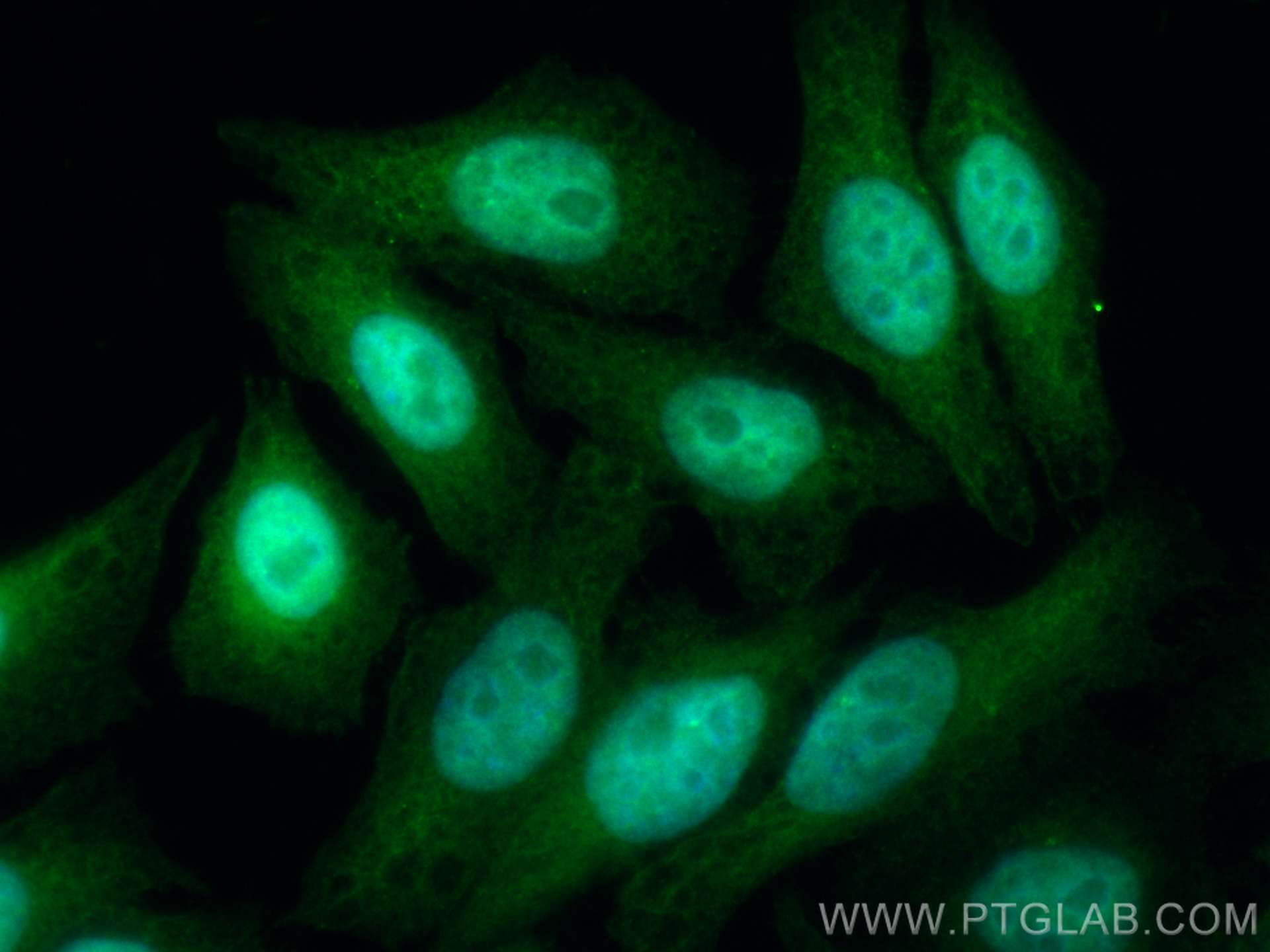 Immunofluorescence (IF) / fluorescent staining of HepG2 cells using CoraLite® Plus 488-conjugated PBK Polyclonal antib (CL488-16110)