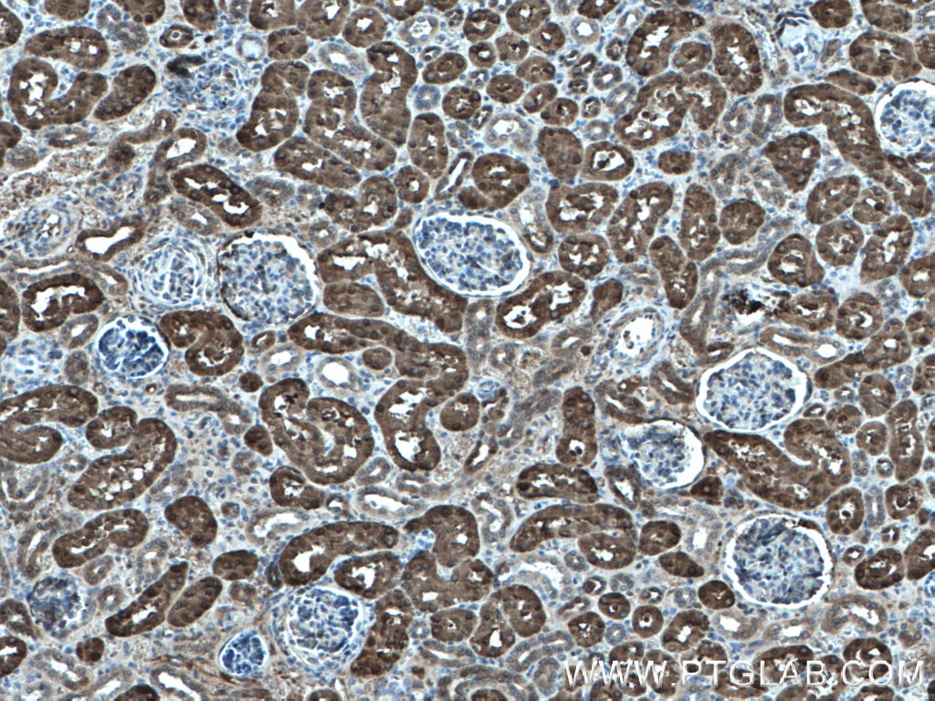 Immunohistochemistry (IHC) staining of human kidney tissue using PBLD Polyclonal antibody (27891-1-AP)