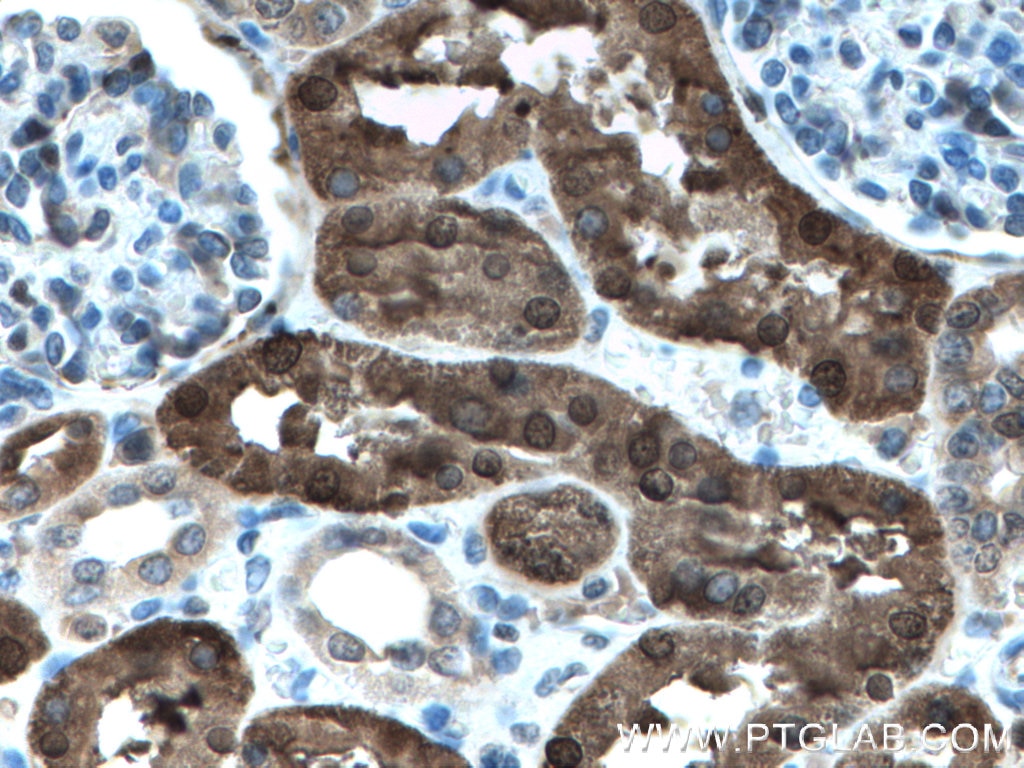 Immunohistochemistry (IHC) staining of human kidney tissue using PBLD Polyclonal antibody (27891-1-AP)