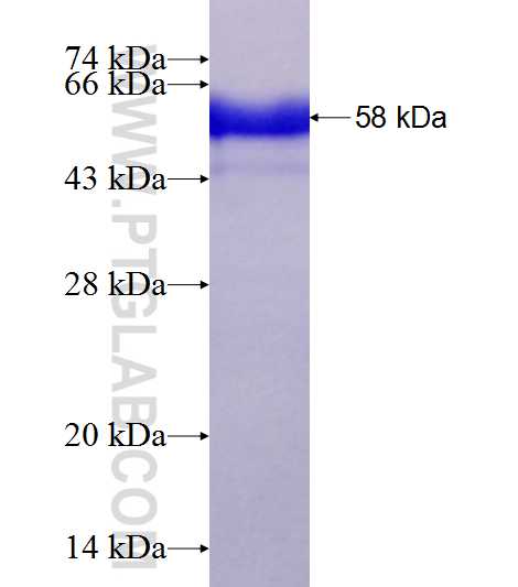 PBLD fusion protein Ag23591 SDS-PAGE