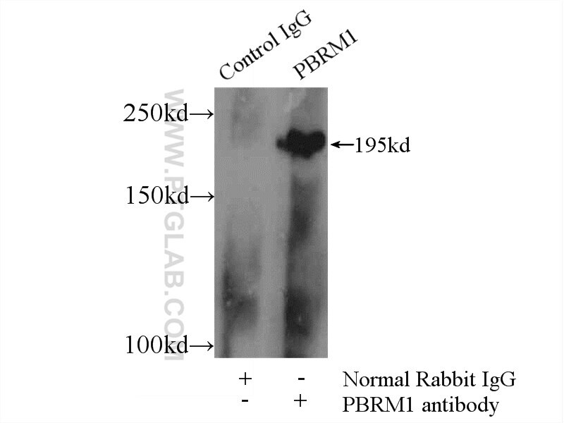 PBRM1