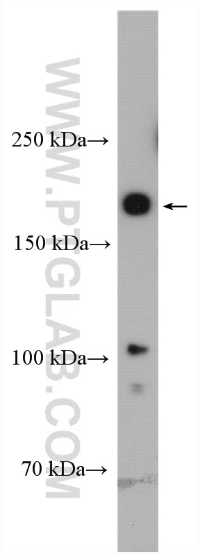 Western Blot (WB) analysis of Jurkat cells using PBRM1 Polyclonal antibody (12563-1-AP)