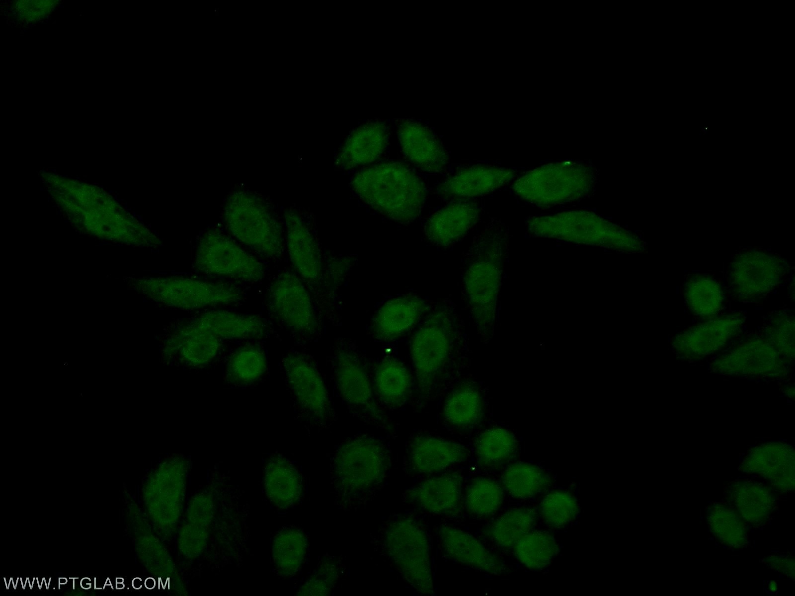 Immunofluorescence (IF) / fluorescent staining of HeLa cells using PBX1 Polyclonal antibody (18204-1-AP)