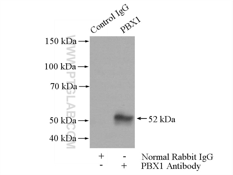 Immunoprecipitation (IP) experiment of A2780 cells using PBX1 Polyclonal antibody (18204-1-AP)