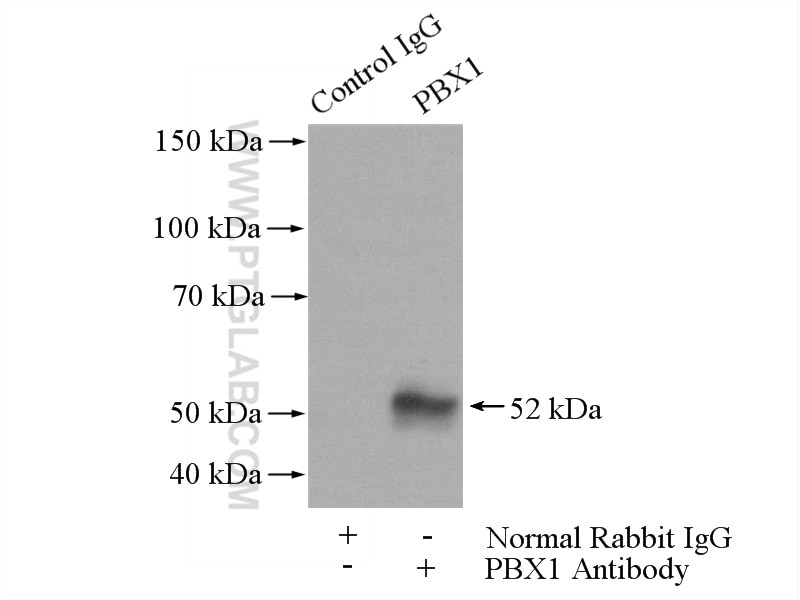 IP experiment of A2780 using 18204-1-AP