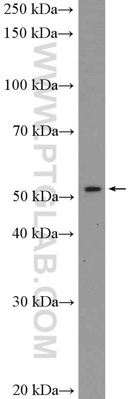 Western Blot (WB) analysis of A2780 cells using PBX1 Polyclonal antibody (18204-1-AP)