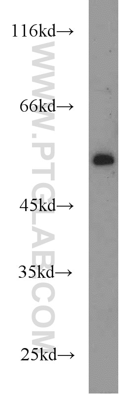 Western Blot (WB) analysis of A2780 cells using PBX1 Polyclonal antibody (18204-1-AP)