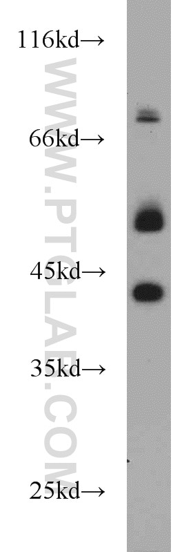 Western Blot (WB) analysis of HeLa cells using PBX1 Polyclonal antibody (18204-1-AP)