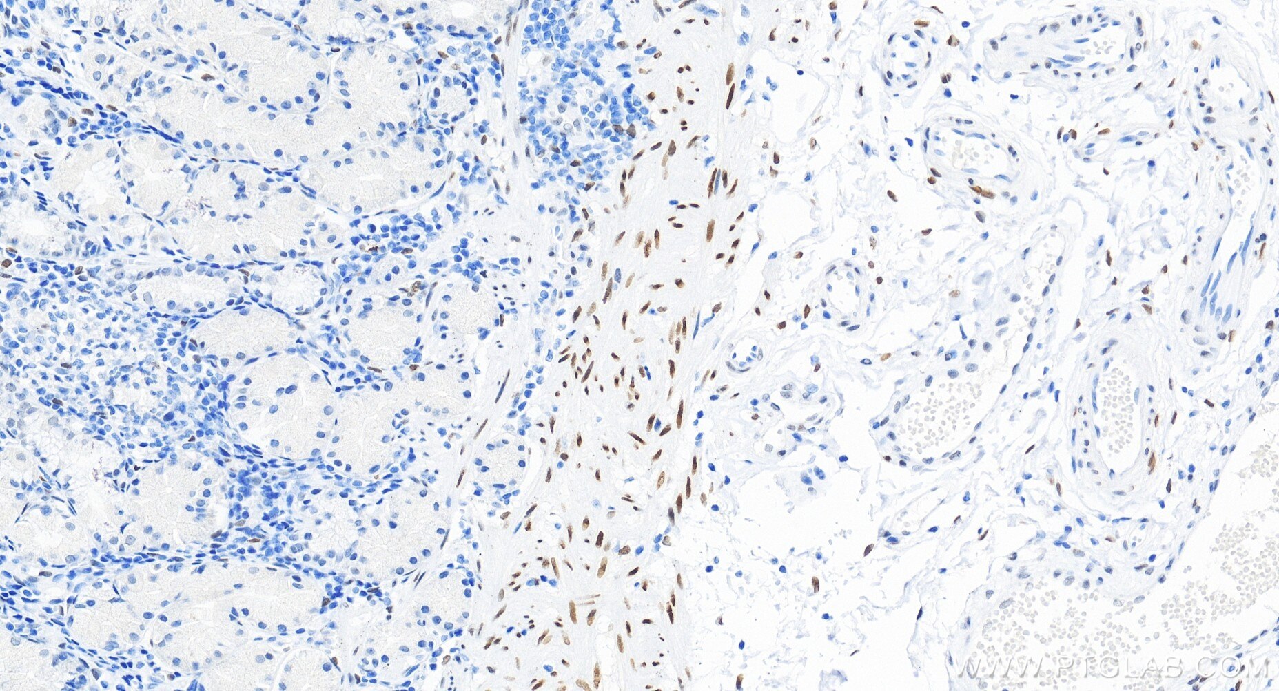 Immunohistochemistry (IHC) staining of human stomach tissue using PBX1 Recombinant monoclonal antibody (86504-3-RR)