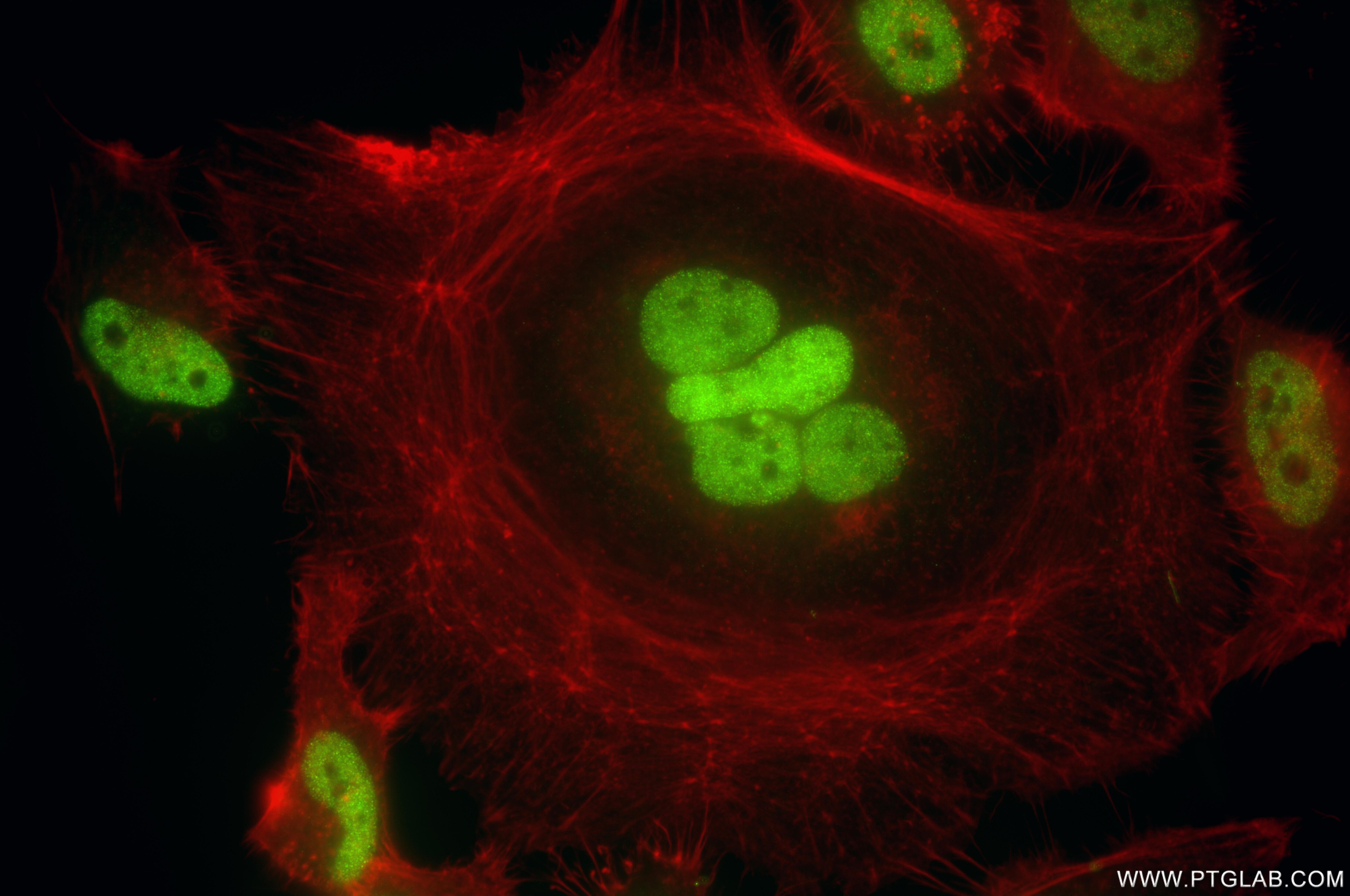 Immunofluorescence (IF) / fluorescent staining of HeLa cells using PBX1 Recombinant antibody (86504-3-RR)