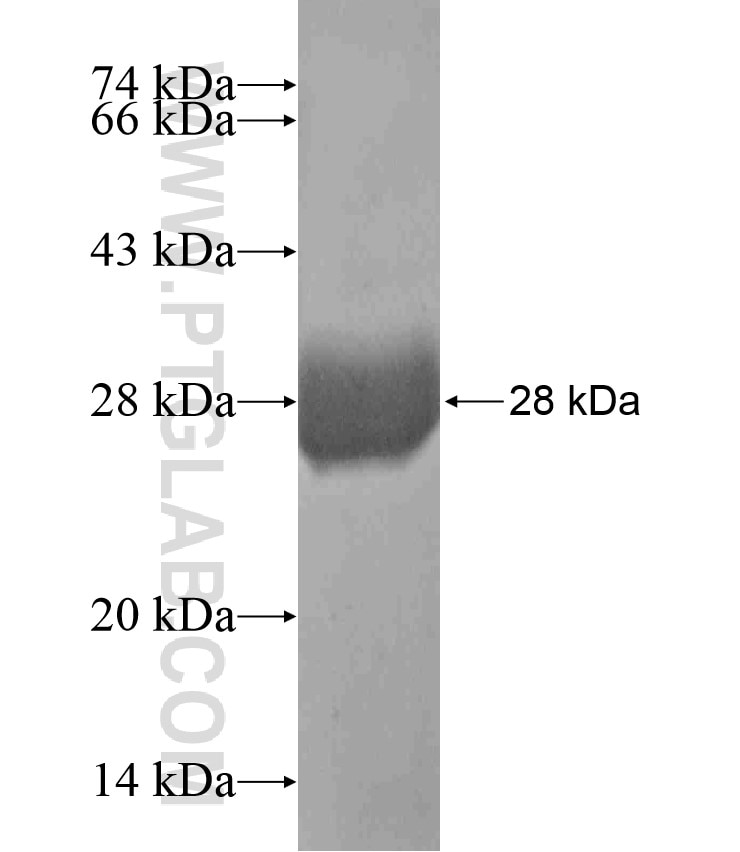 PBX1 fusion protein Ag17765 SDS-PAGE