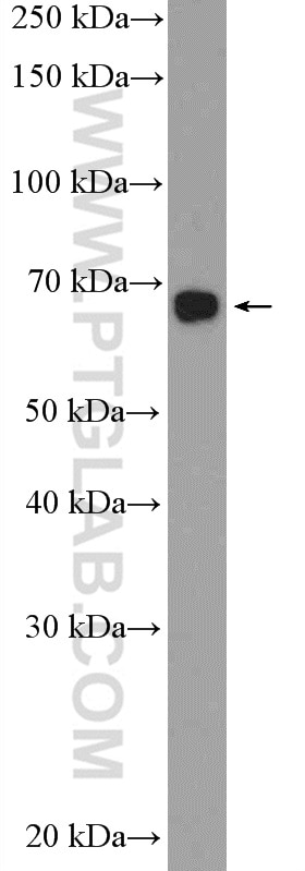 PBX2 Polyclonal antibody