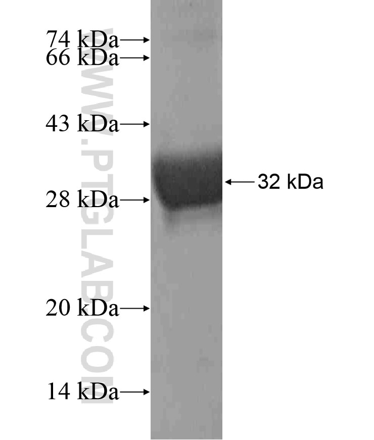 PBX2 fusion protein Ag17766 SDS-PAGE