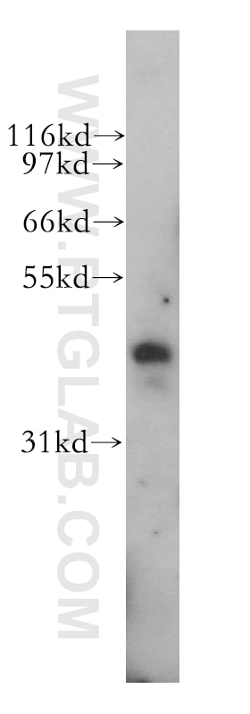 Western Blot (WB) analysis of human lung tissue using PBX3 Polyclonal antibody (12571-1-AP)