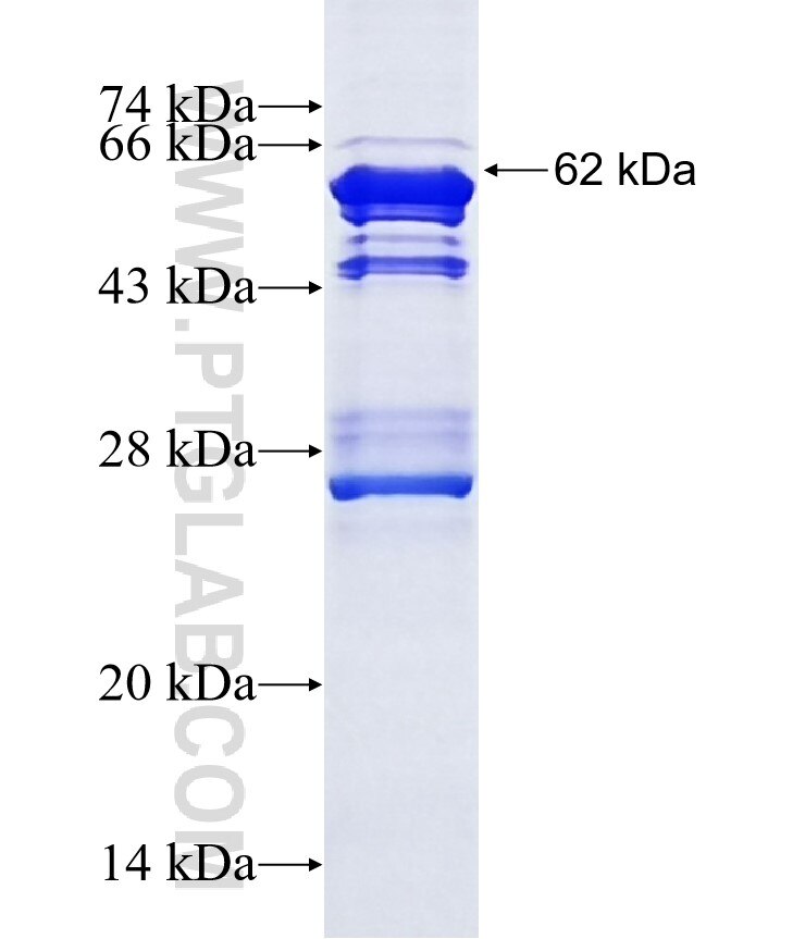 PBX3 fusion protein Ag3239 SDS-PAGE