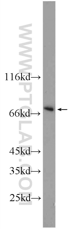 Western Blot (WB) analysis of Jurkat cells using PBX4 Polyclonal antibody (22323-1-AP)