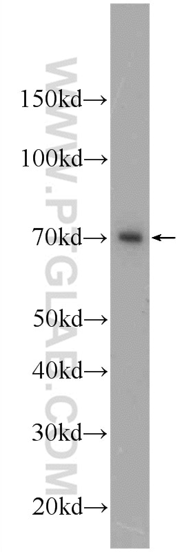 Western Blot (WB) analysis of A2780 cells using PBX4 Polyclonal antibody (22323-1-AP)