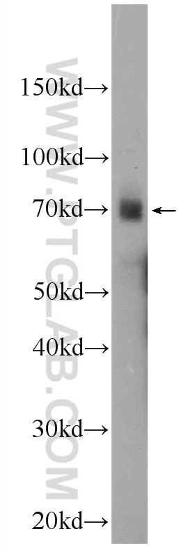 Western Blot (WB) analysis of SKOV-3 cells using PBX4 Polyclonal antibody (22323-1-AP)