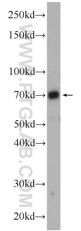 Western Blot (WB) analysis of HEK-293 cells using PBX4 Polyclonal antibody (22323-1-AP)