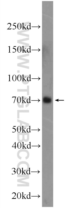 Western Blot (WB) analysis of COLO 320 cells using PBX4 Polyclonal antibody (22323-1-AP)
