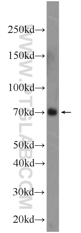 WB analysis of COLO 320 using 22323-1-AP