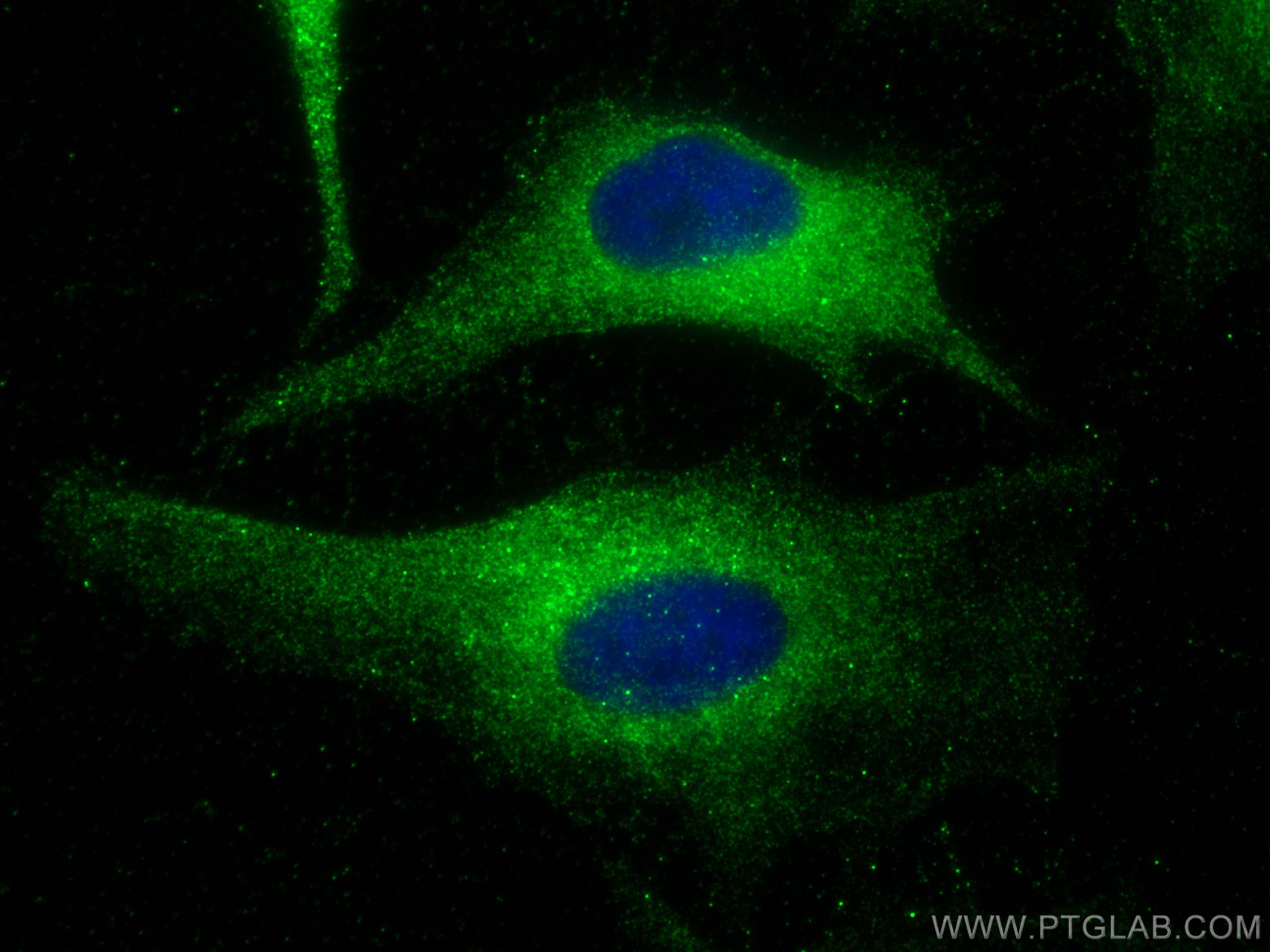 Immunofluorescence (IF) / fluorescent staining of HeLa cells using PBXIP1 Polyclonal antibody (12102-1-AP)