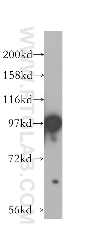Western Blot (WB) analysis of BxPC-3 cells using PBXIP1 Polyclonal antibody (12102-1-AP)