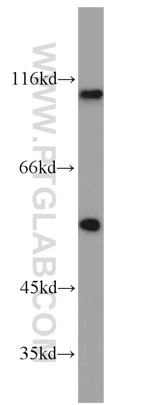 Western Blot (WB) analysis of A549 cells using PBXIP1 Polyclonal antibody (12102-1-AP)