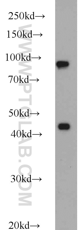 Western Blot (WB) analysis of HeLa cells using PBXIP1 Polyclonal antibody (12102-1-AP)