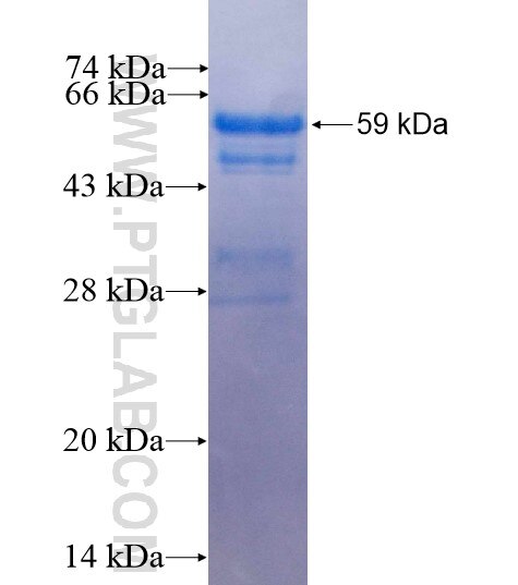 PBXIP1 fusion protein Ag2746 SDS-PAGE
