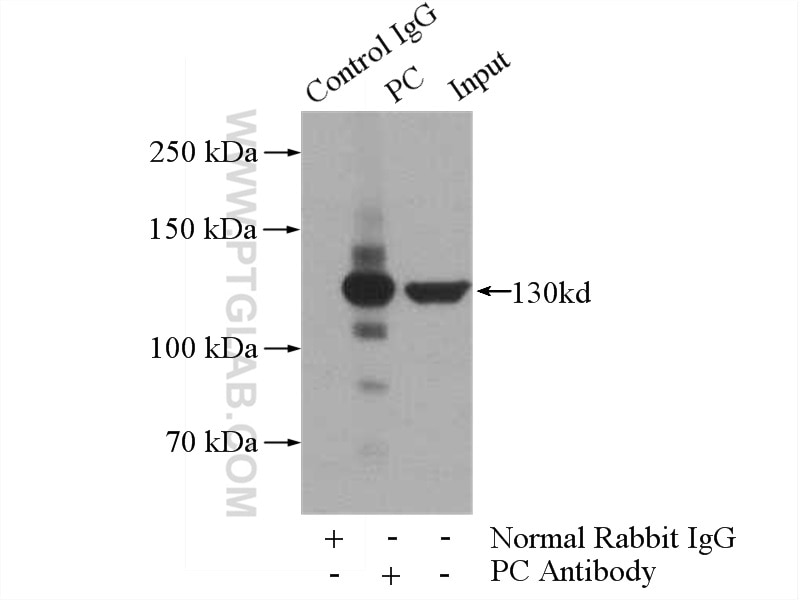 Immunoprecipitation (IP) experiment of mouse liver tissue using Pyruvate Carboxylase Polyclonal antibody (16588-1-AP)