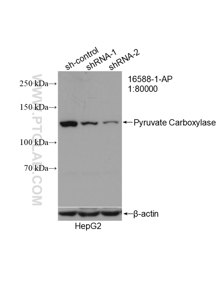 Western Blot (WB) analysis of HepG2 cells using Pyruvate Carboxylase Polyclonal antibody (16588-1-AP)