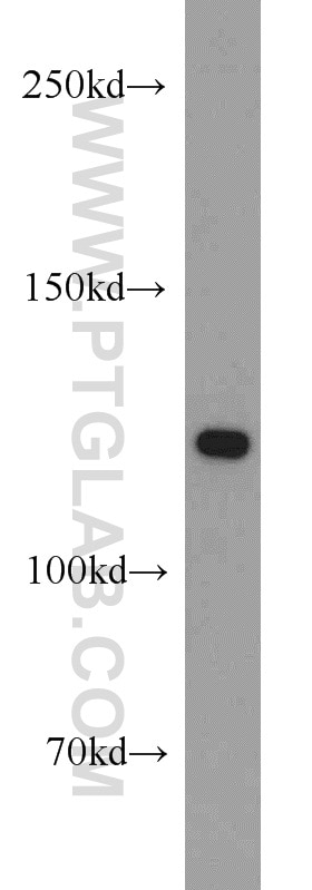 Pyruvate Carboxylase Polyclonal antibody